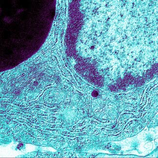 Cell 1a