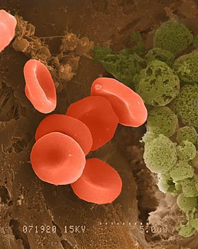 More Red Blood Cells