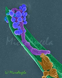 Mold